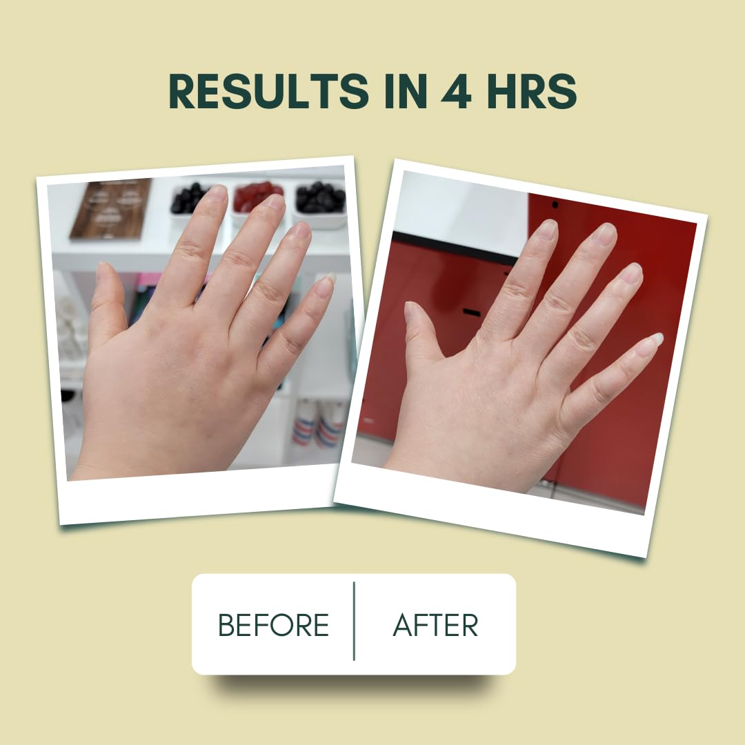 IMARAÏS Beauty by Sommer Ray Depuff Anti-Bloat Gummy - English Chamomile, Hibiscus, Ginger - Supports Skin Health, Gut Health, Skin Bloat & Puffiness - Sugar Free, PETA-Certified