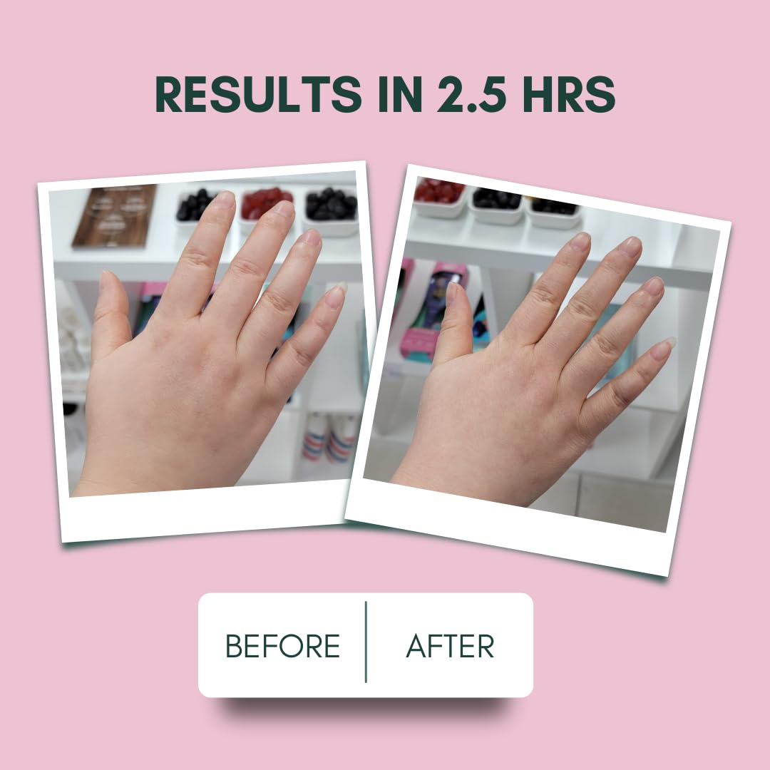 IMARAÏS Beauty by Sommer Ray Depuff Anti-Bloat Gummy - English Chamomile, Hibiscus, Ginger - Supports Skin Health, Gut Health, Skin Bloat & Puffiness - Sugar Free, PETA-Certified