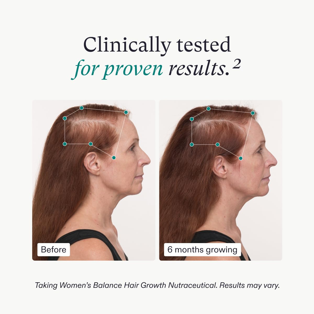 Nutrafol Women's Balance Hair Growth Supplement and Hair Serum, Ages 45 and Up, Clinically Tested for Visible Thickness and Strength - 1 Month Supply, 1.7 Fl Oz Bottle