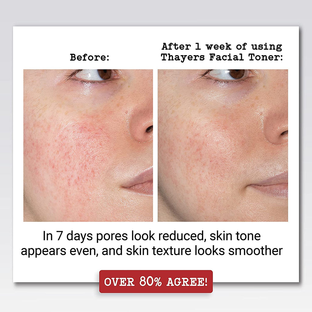 Thayers Witch Hazel with Aloe Vera Rose Petal - 12 fl oz