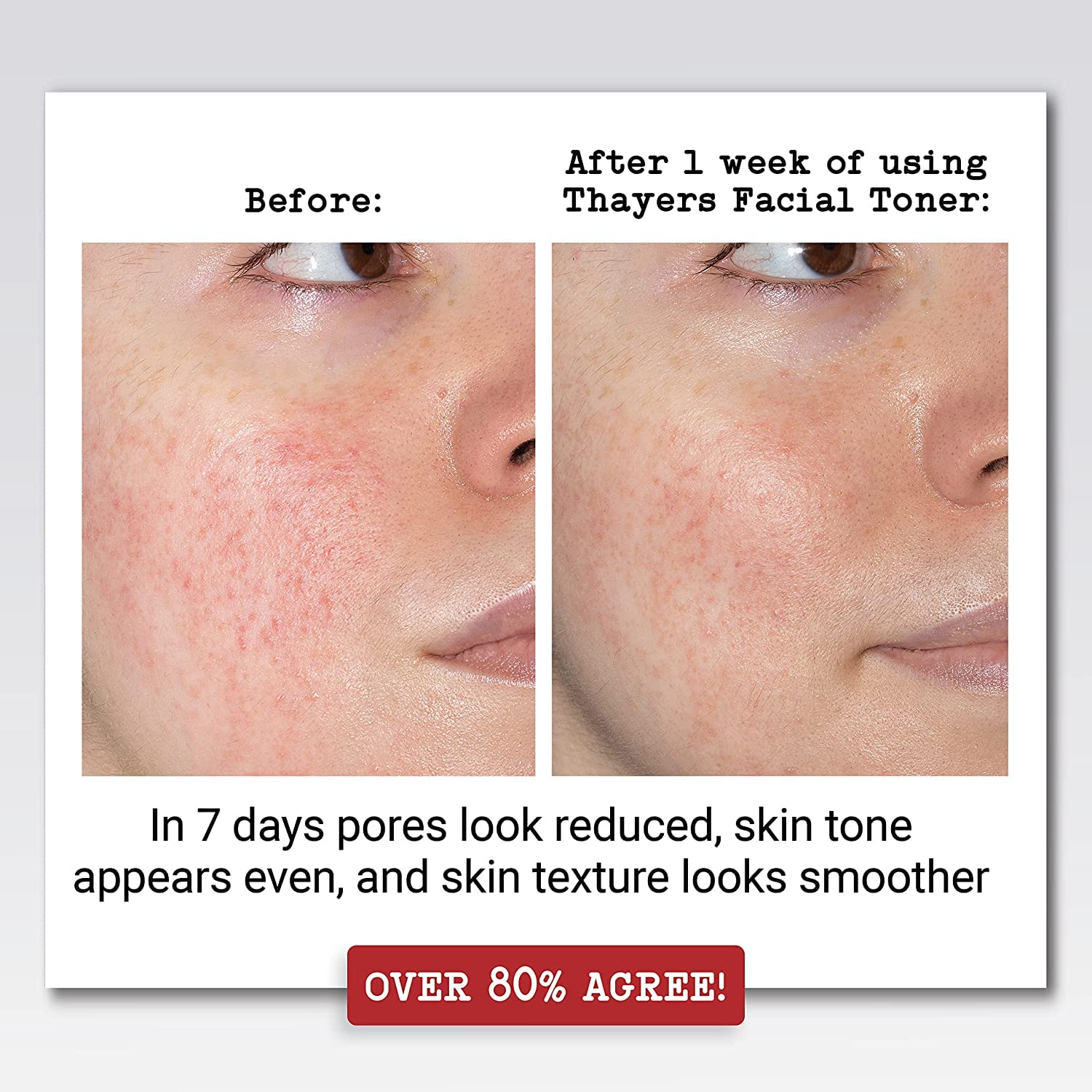 Thayers Witch Hazel with Aloe Vera Rose Petal - 12 fl oz