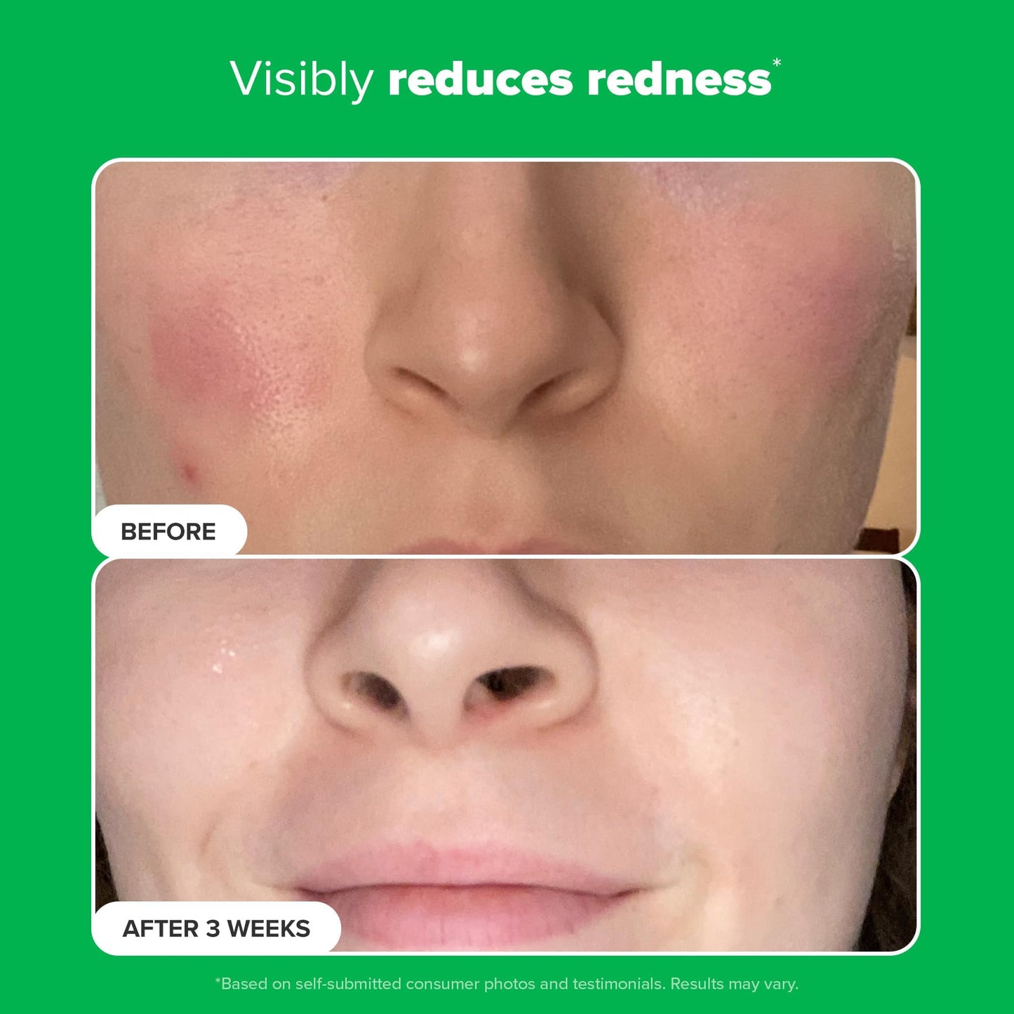 Paula's Choice BOOST 10% 壬二酸增强霜凝胶，甘草提取物和水杨酸，无油亮肤精华，1 盎司