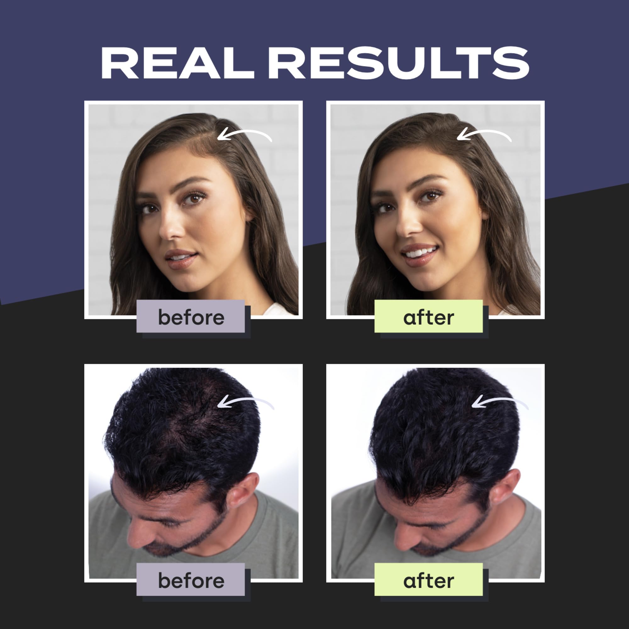 Toppik Hair Building Fibers, Black, 12g Fill In Fine or Thinning Hair, Instantly Thicker, Fuller Looking, 9 Shades for Men & Women, Keratin Protein Formula