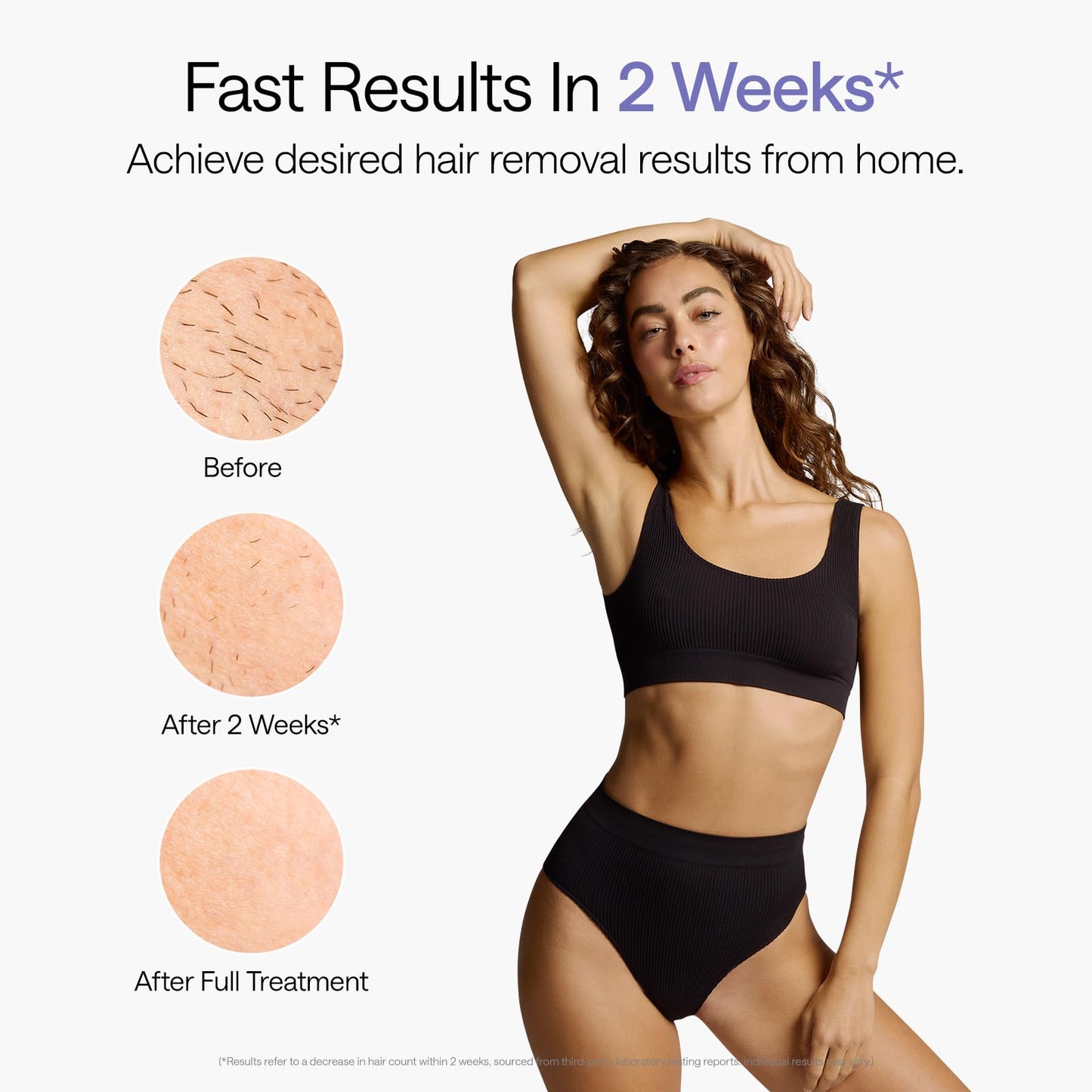 Épilation laser Ulike, Air 10 IPL pour femmes et hommes, contact refroidissant à 18 °C, double éclairage, capteur cutané et mode SHR* pour une épilation quasi indolore, efficace et durable à domicile