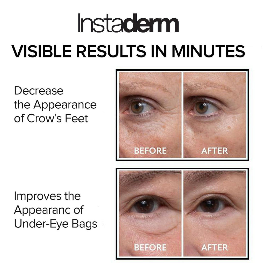 Instant Eye Tightener – Instantly Reduces Under Eye Bags, Puffiness, Dark Circles, Wrinkles & Crow's Feet. Naturally Ageless Hydrating Cream. Disappears Before Your Eyes Within Minutes.