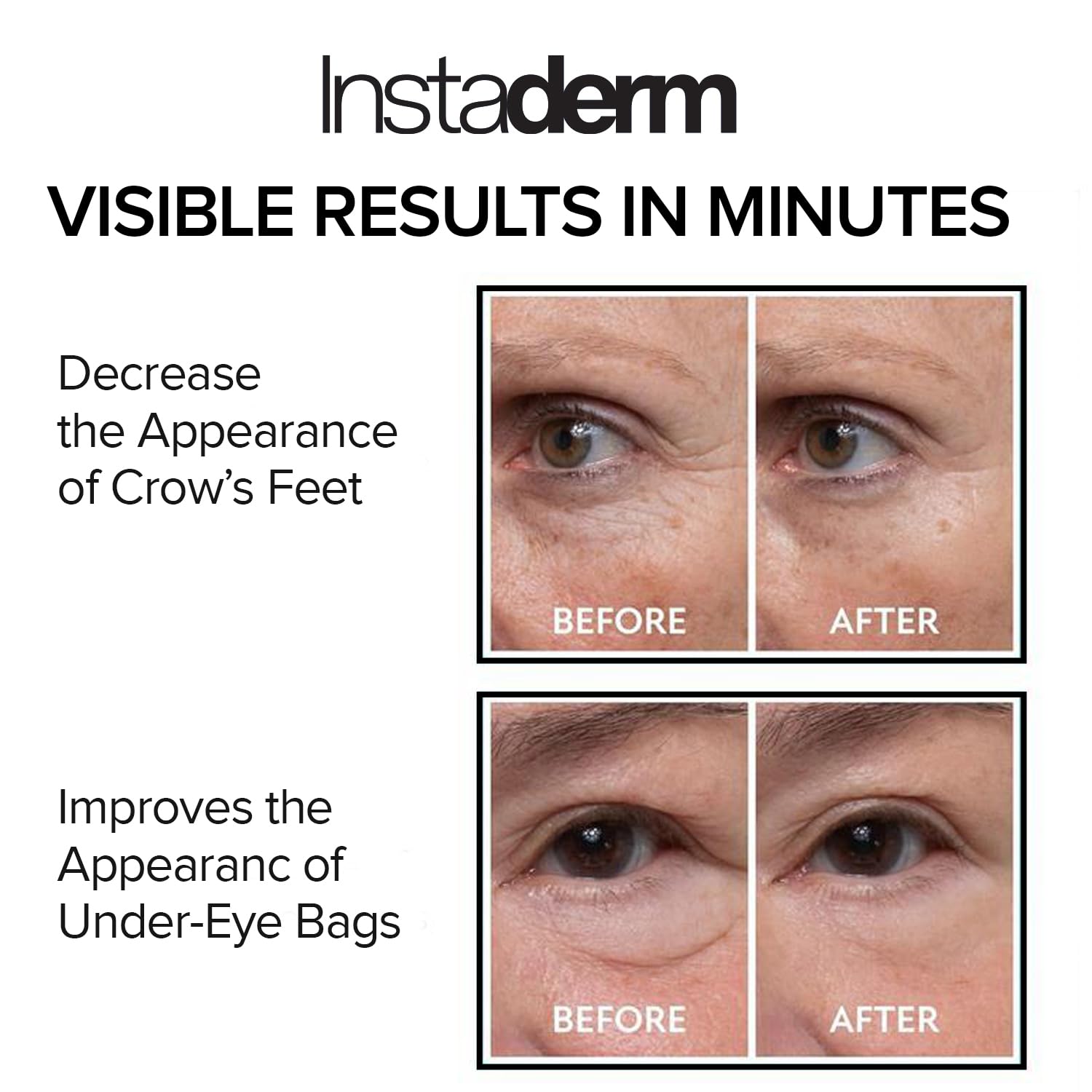Instant Eye Tightener – Instantly Reduces Under Eye Bags, Puffiness, Dark Circles, Wrinkles & Crow's Feet. Naturally Ageless Hydrating Cream. Disappears Before Your Eyes Within Minutes.