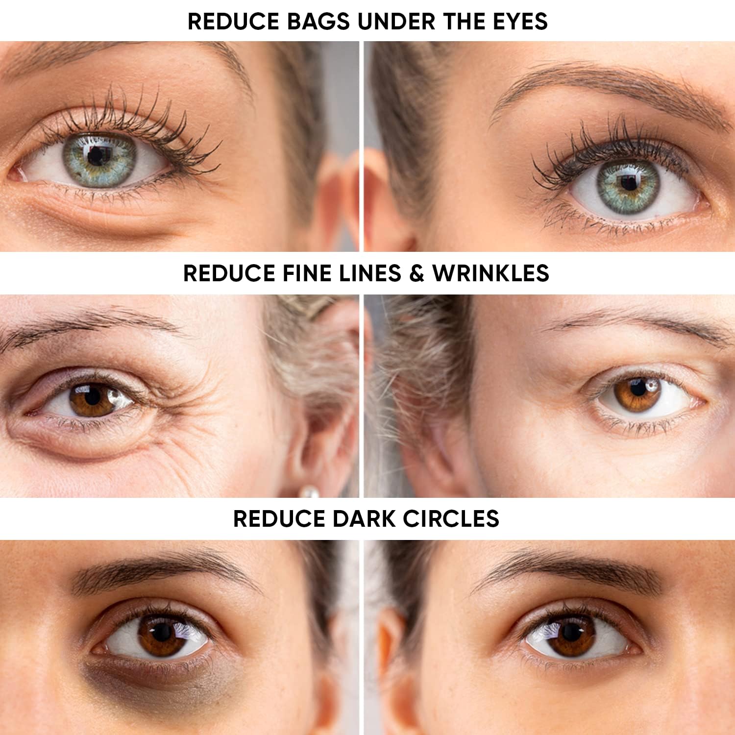 Instant Eye Tightener – Instantly Reduces Under Eye Bags, Puffiness, Dark Circles, Wrinkles & Crow's Feet. Naturally Ageless Hydrating Cream. Disappears Before Your Eyes Within Minutes.
