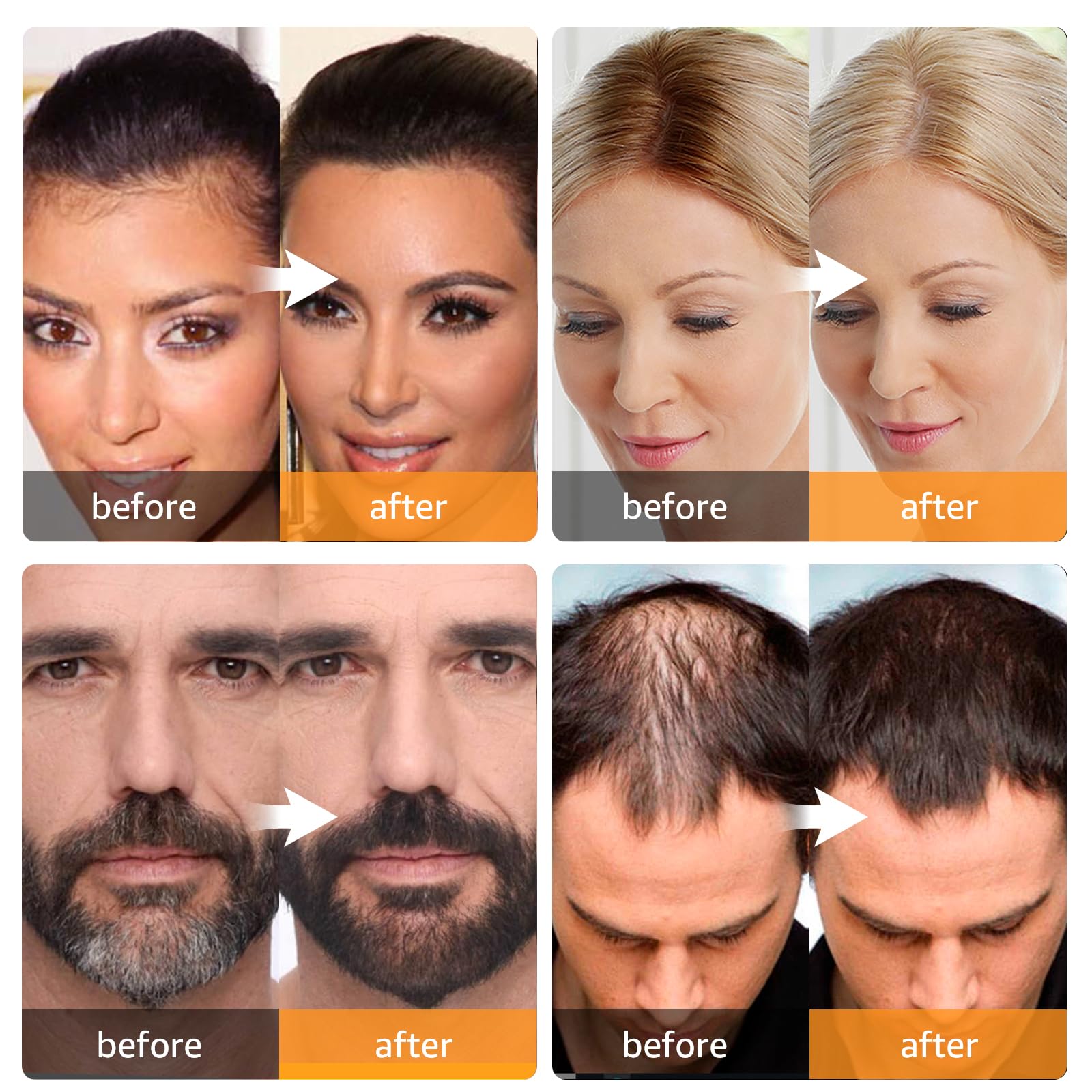 Tan Root Touch Up Instantly Gray Coverage Hairline Powder, Conceal Hair Loss and Thinning For Women Men, Hair Fibers (Black)