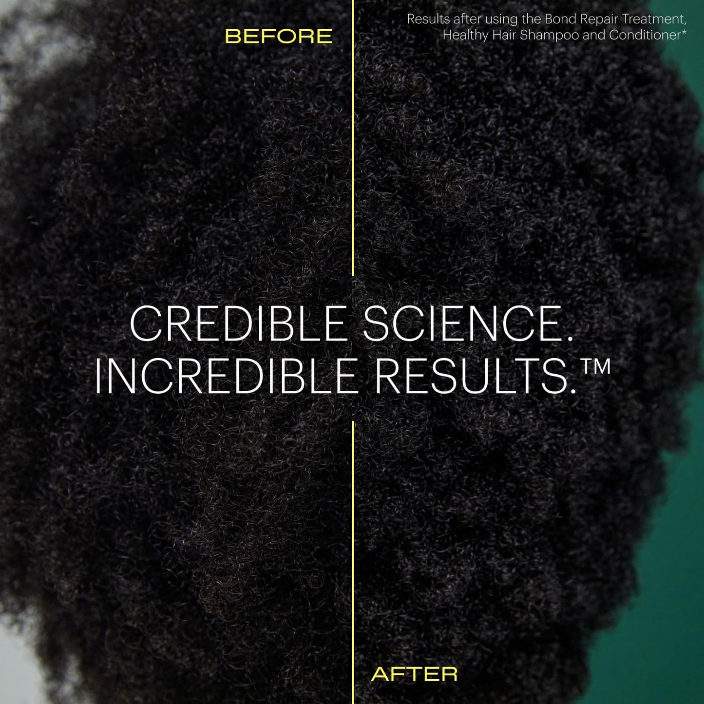 epres Healthy Hair Conditioner, Bond Repair for Stronger Shinier Hair, Lightweight Formula Backed By Science, Scalp Health & Hydration, 32 oz