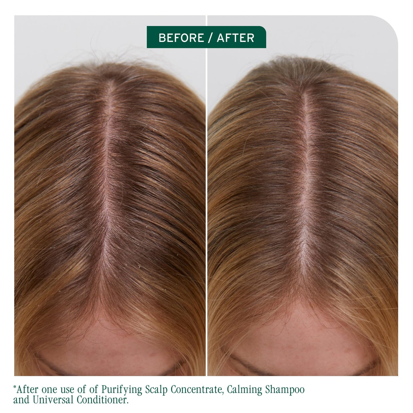 Dark Olive Green Biolage Scalp Sync Calming Shampoo - Gently Cleanses Dry & Sensitive Scalps, Hydrates & Soothes, Fermented Tea Blend & Glycolic Acid, Vegan & Paraben-Free
