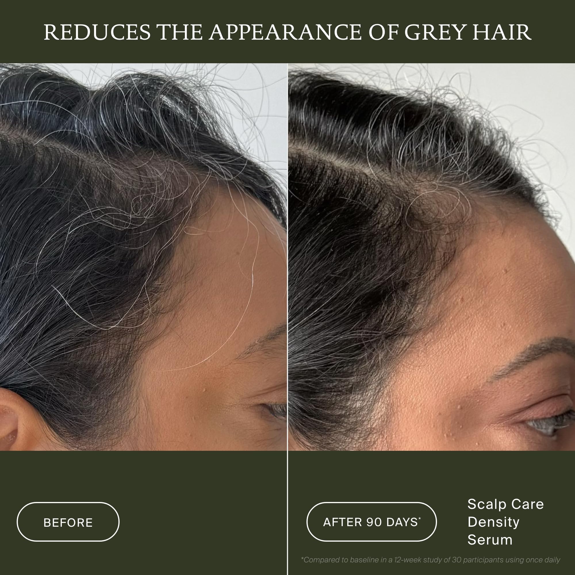 Living Proof Scalp Care Density Serum