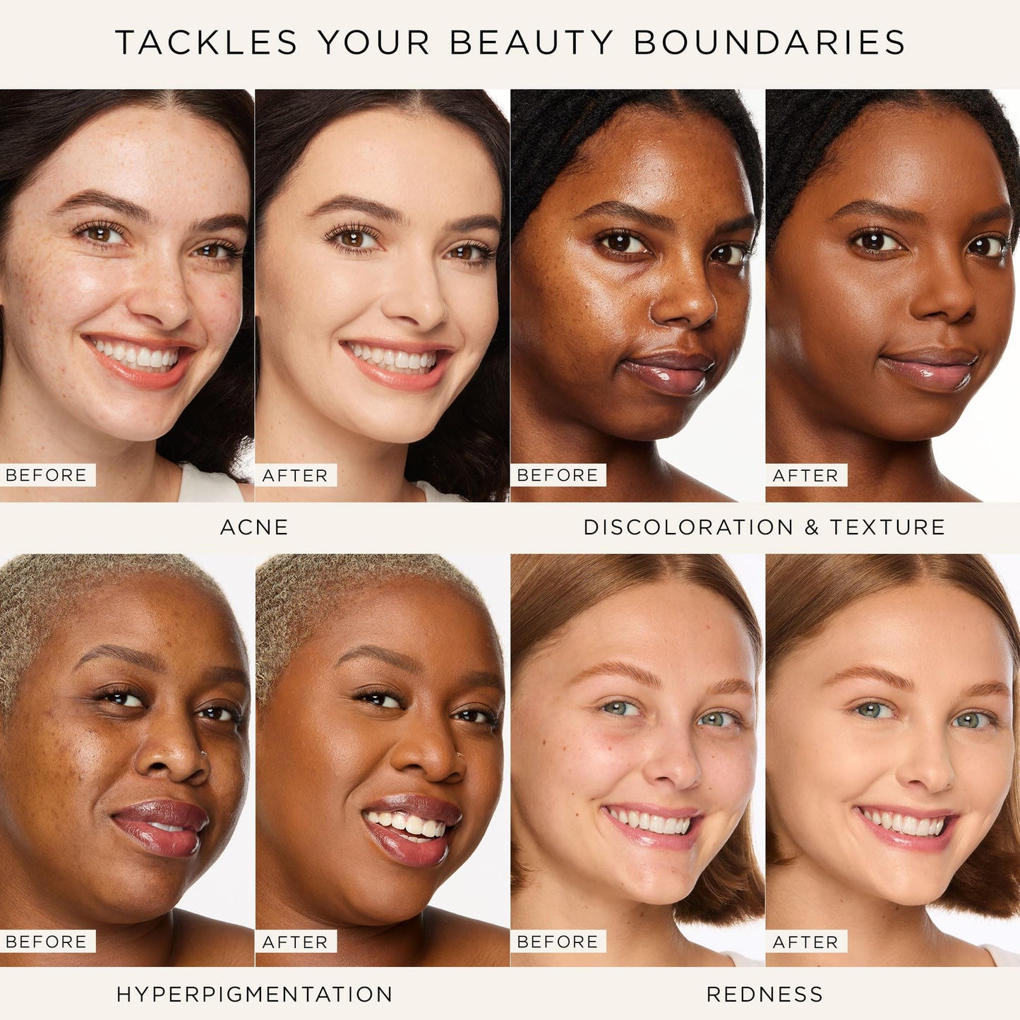 tarte shape tape concealer – Full Size-Coverage, Matte Finish for Under Eye, Dark Circles, Fine Lines, Redness & Discoloration, Longwear, Dermatologist-Tested, Vegan, Cruelty-Free