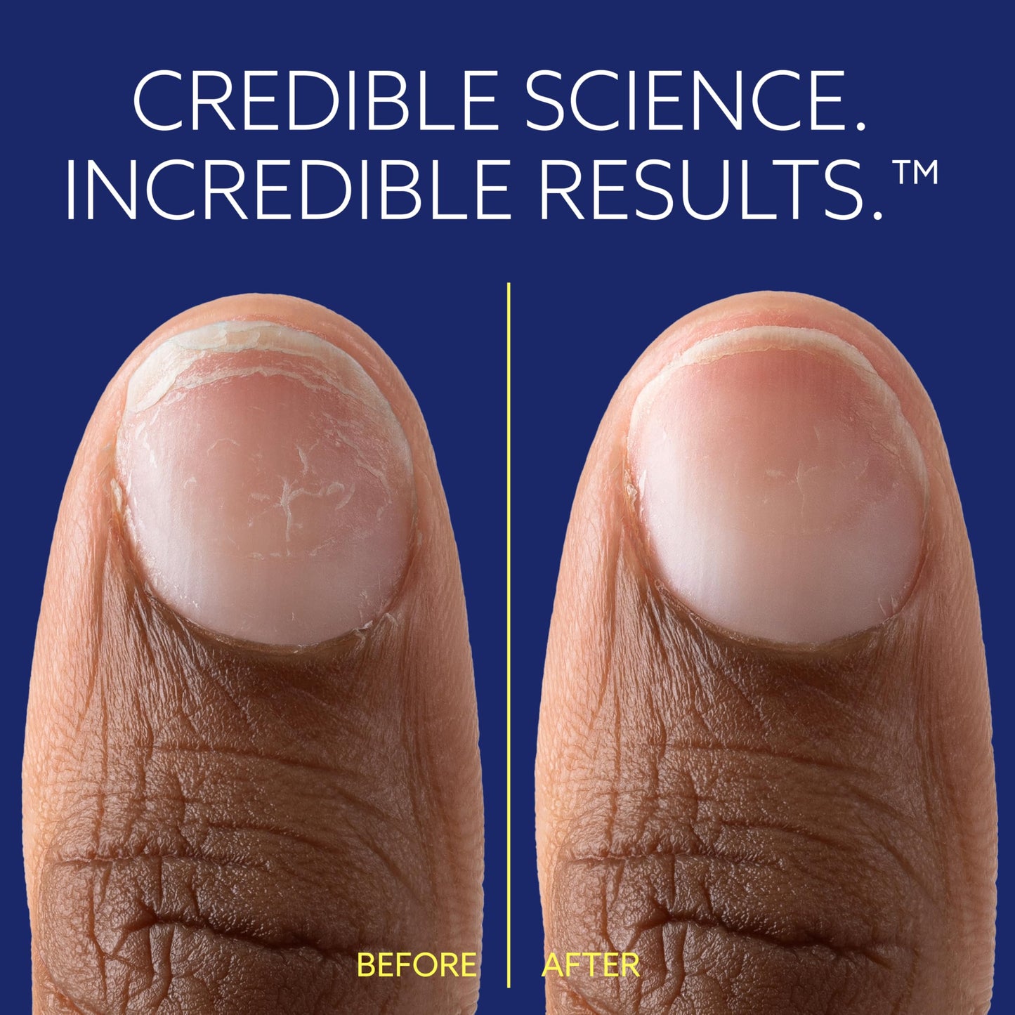 ePhD Bond Repair Nail Treatment, Nail Repair that Strengthens, Restores & Rebuilds Brittle Nails, Strengthens from Within, Formula for Damaged, or Post-Gel Nails, Use Alone or as a Polish Base