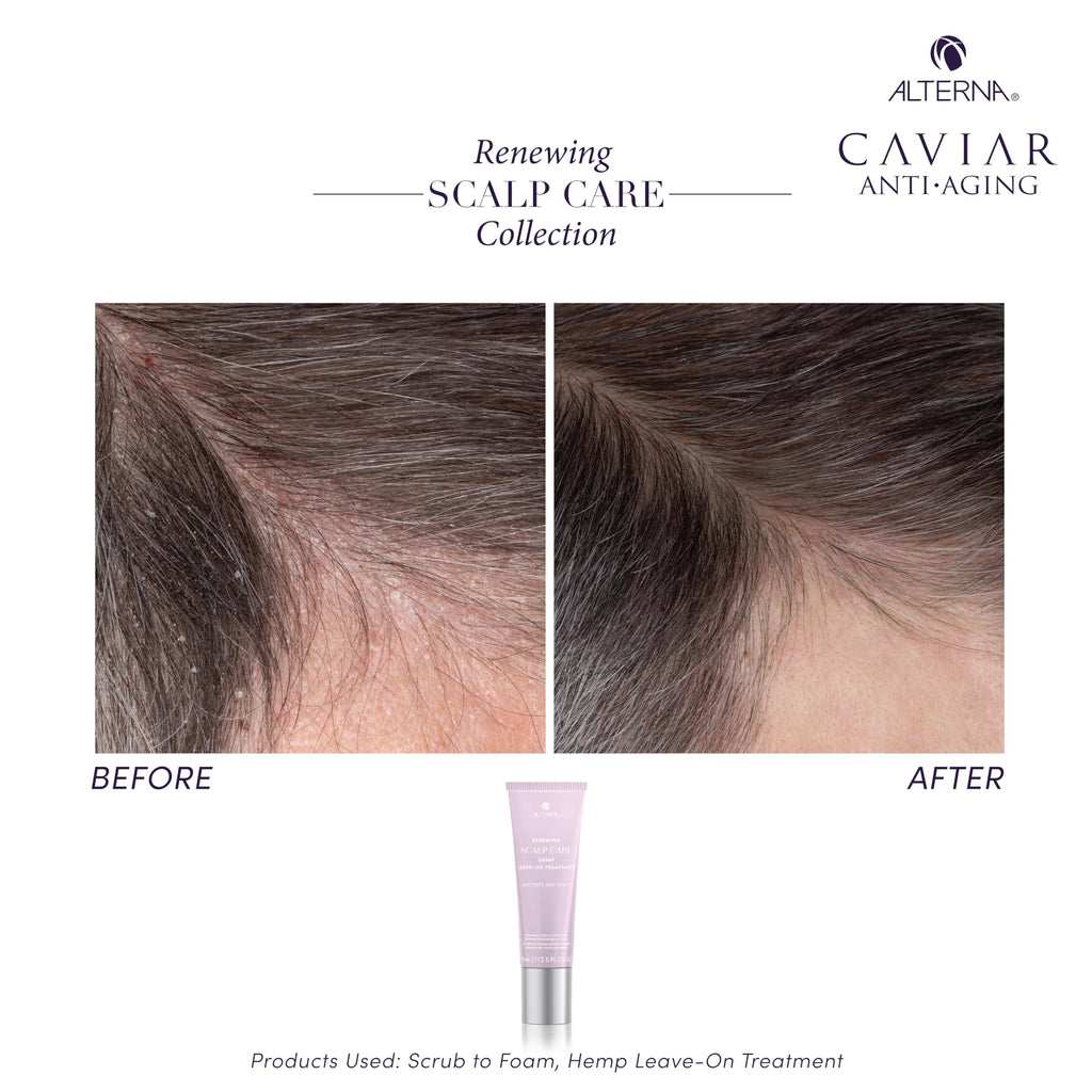 Alterna Haircare Renewing Scalp Care Hemp Leave On Vegan Hair and Scalp Treatment, 2.5 Fl Oz Lightweight and Fast Absorbing to Moisturize, Soothe and Calm Scalp