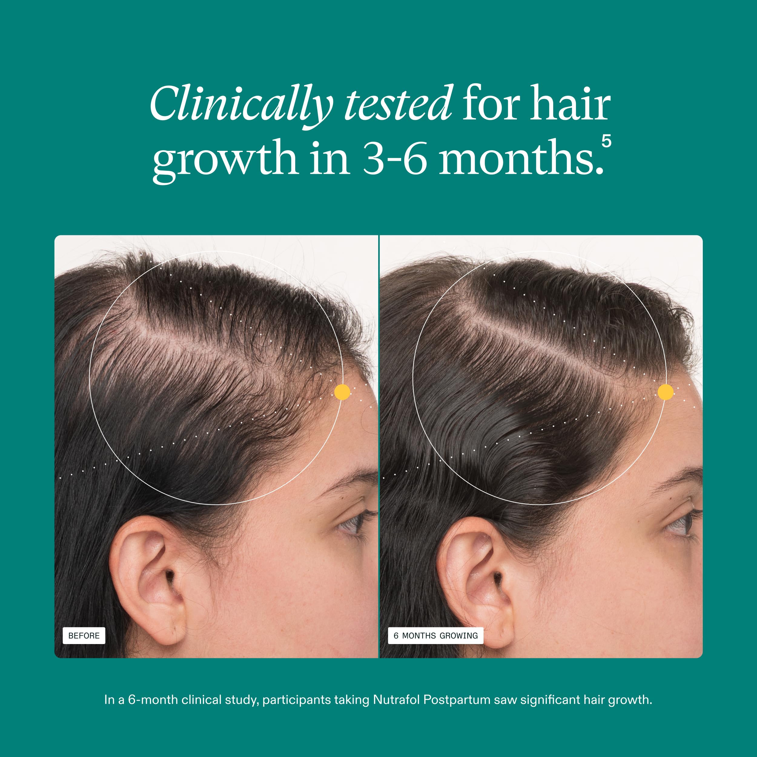 Nutrafol Postpartum Hair Growth Supplements, Clinically Tested for Visibly Thicker Hair and Less Shedding, Breastfeeding-friendly - 3 Month Supply, Pack of 3