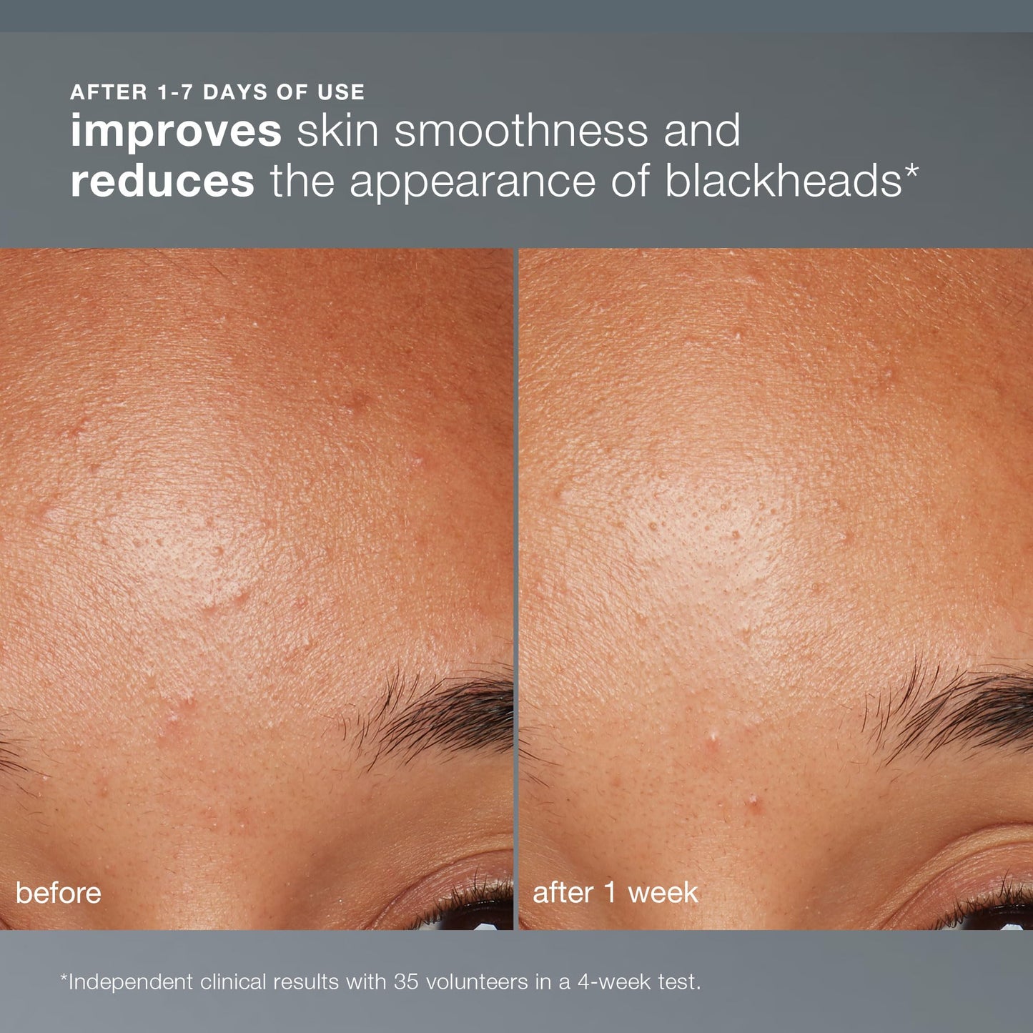 Dark Salmon Dermalogica Daily Microfoliant, Face Exfoliator Scrub Powder with Salicylic Acid and Papaya Enzyme, Achieve Brighter, Smoother Skin Daily