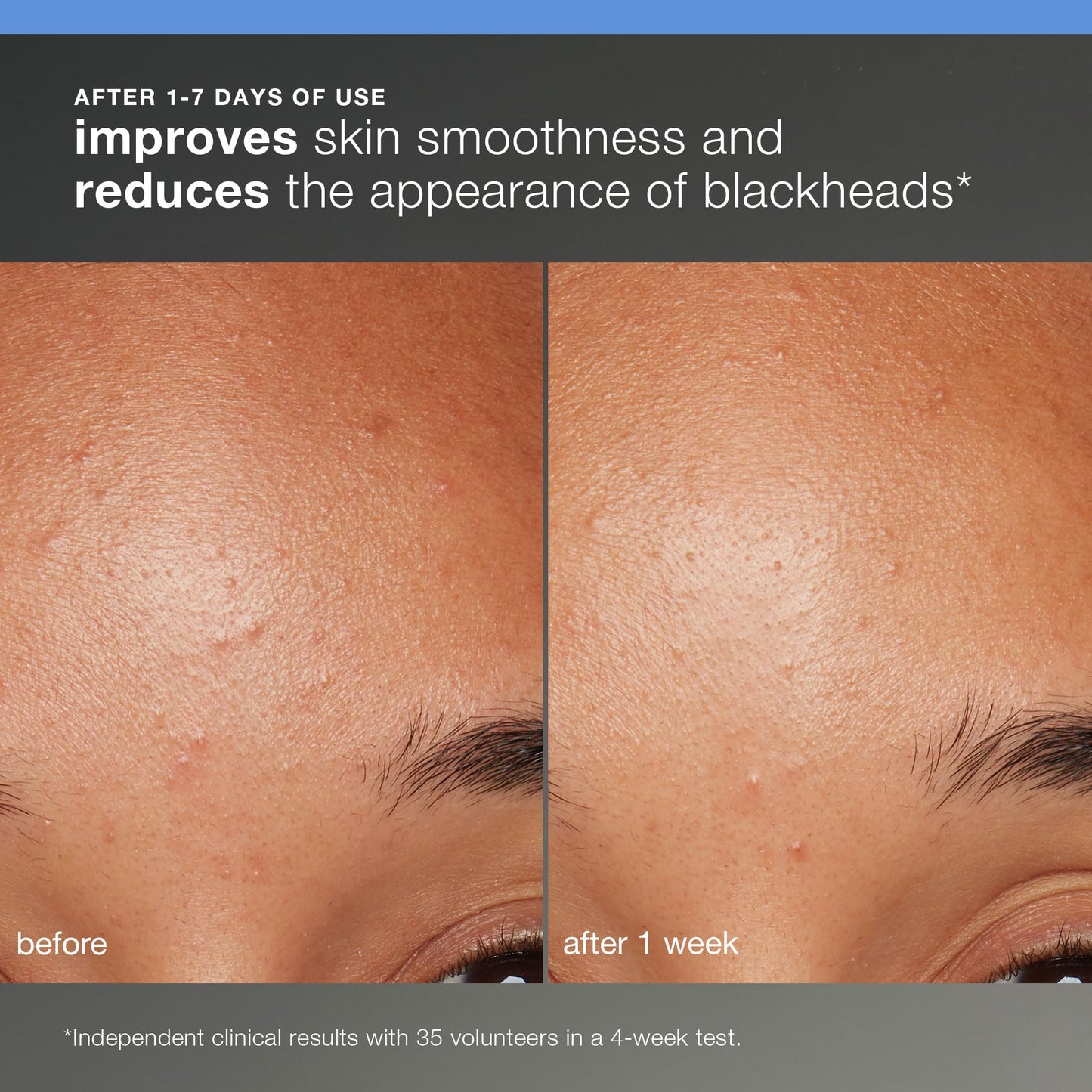 Dermalogica Discover Healthy Skin Kit | Includes: Precleanse, Face Wash, Face Exfoliator, & Moisturizer | Wash Away Impurities to Reveal Glowing Skin