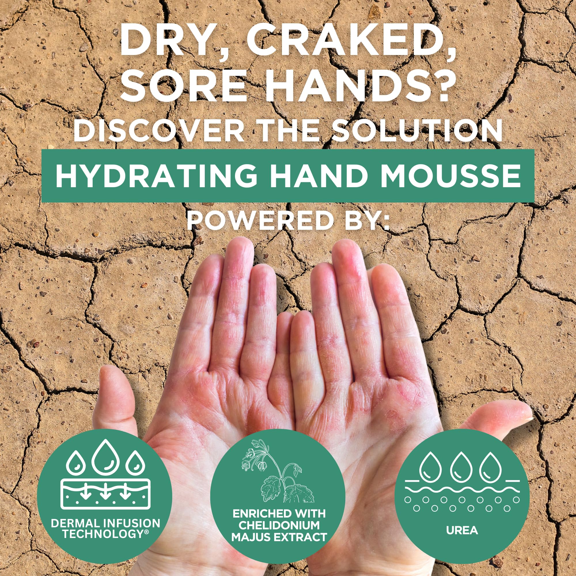 Footlogix Hydrating Hand Mousse with Dermal Infusion Technology® | Deep Hydration for Dry Hands | Urea-Enriched Formula | Fast-Absorbing | 4.23 ozl/119.9 g/125 ml